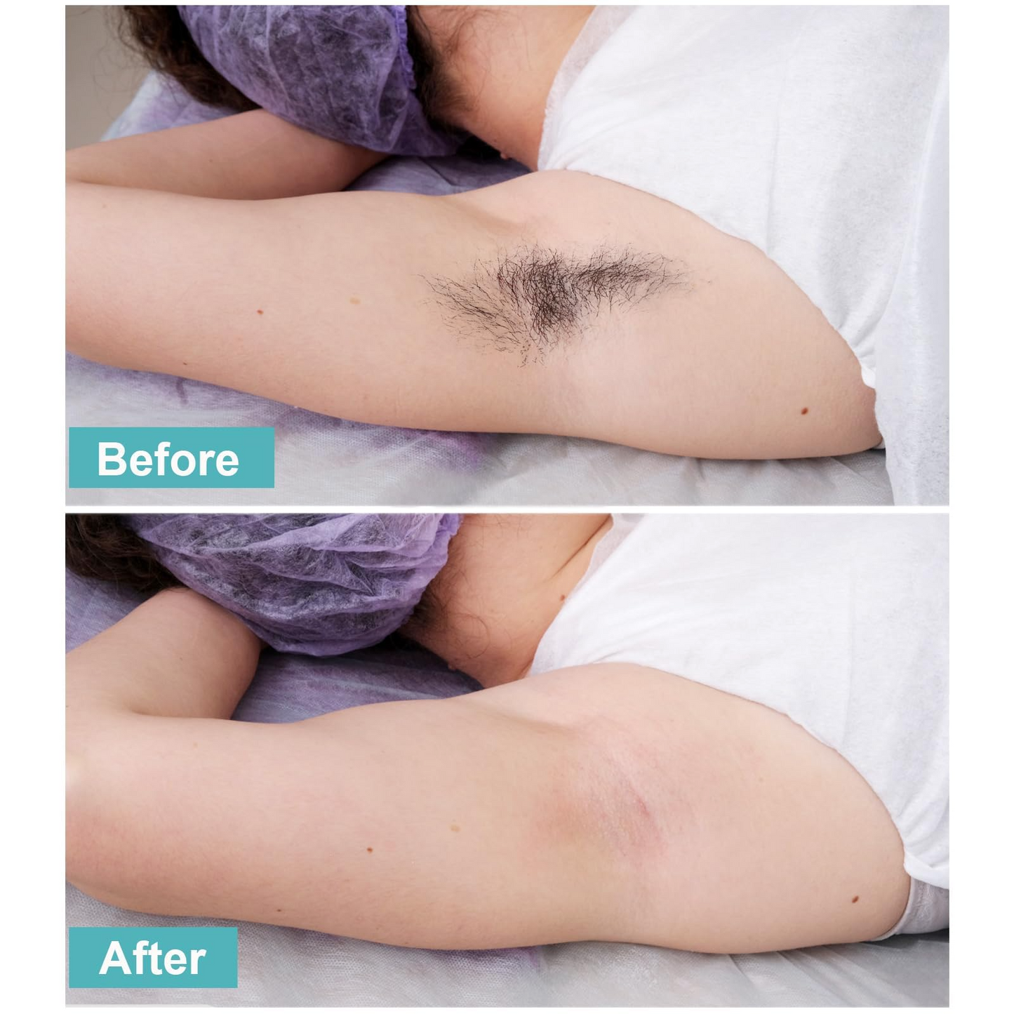 Charmonic 300 Pcs Large Wax Strips, Non-Woven Waxing Strips for Sugar Wax and Soft Wax, Skin-friendly Depilatory Wax Paper, Eyebrow, Face, Bikini, Body Wax Strips for Hair Removal (Large 2.8" x 7.9")